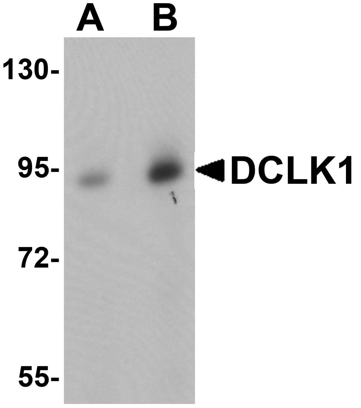 Polyclonal Rabbit anti-Human DCLK / DCLK1 Antibody (IHC, IF, WB)