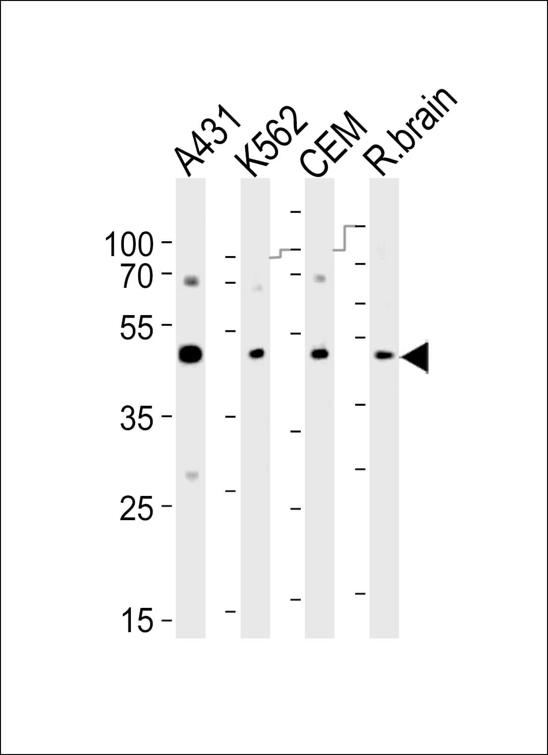 SUV39H2 Antibody (aa360-390)