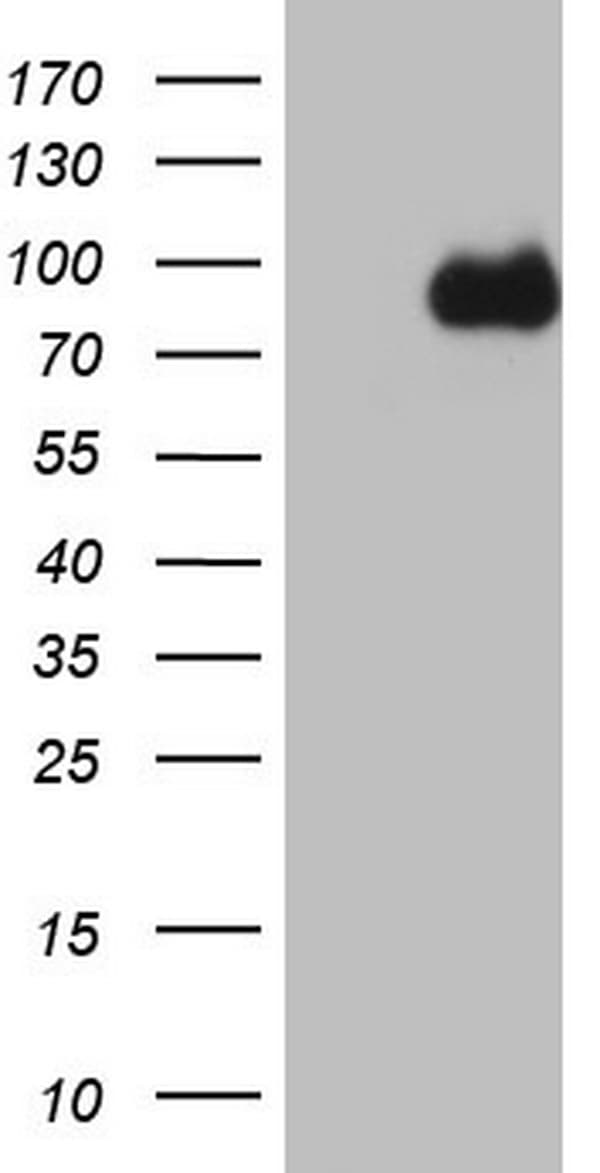 CFI / Complement Factor I Antibody (aa340-583, clone OTI17E6)