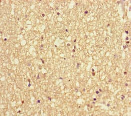 Polyclonal Rabbit anti-Human VAMP1 / VAMP-1 Antibody