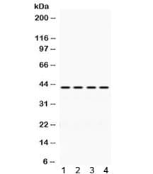 ACTA1 / Skeletal Muscle Actin Antibody
