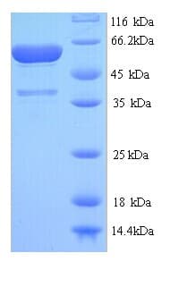 Streptococcus pneumoniae Pneumolysin Protein (Recombinant 6His, N-terminus)