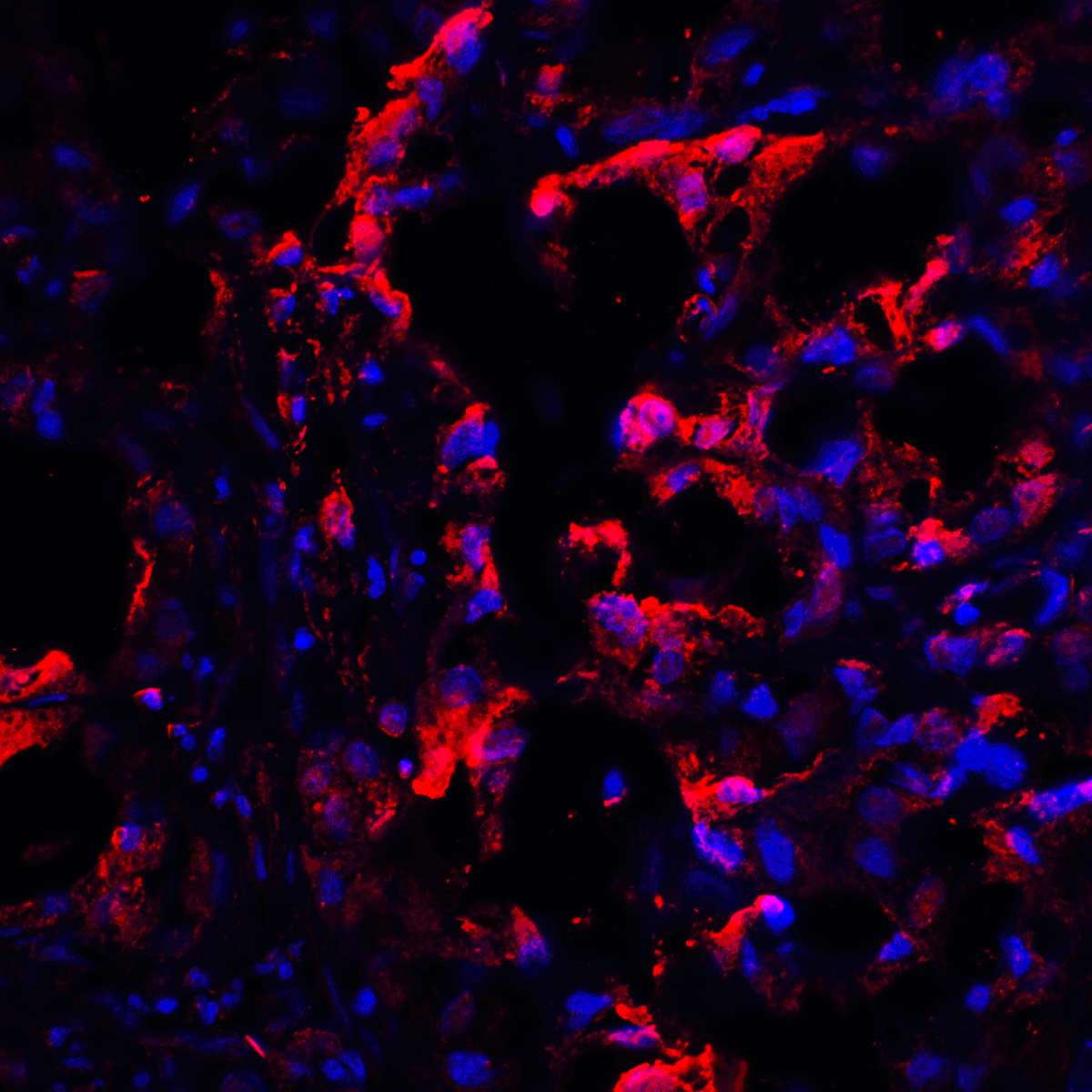 CTLA4 / CD152 Antibody (clone 1E6)