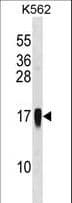 Polyclonal Rabbit anti-Human CCL7 / MCP3 Antibody (aa25-54, WB)