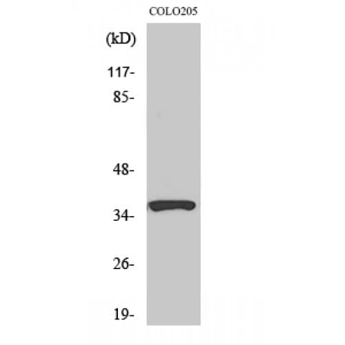 AD037 / RASSF4 Antibody (110-190 aa, Internal)