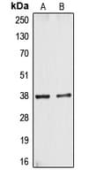 Polyclonal Rabbit anti-Human CYSLTR1 / CYSLT1 Antibody (Internal, WB)