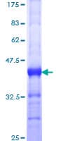 Human MED12 Protein (Recombinant GST, N-terminus)