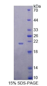 Rat Thymidylate Kinase Protein (Recombinant His-T7, N-terminus)