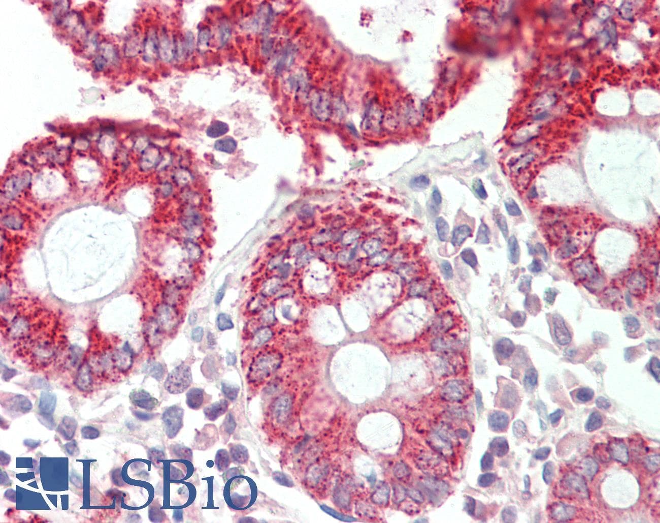 Polyclonal Rabbit anti-Human HMGCS2 / HMG-CoA Synthase 2 Antibody (aa51-100, IHC, WB)