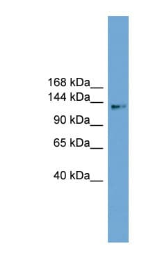 CCDC146 Antibody (aa863-912)