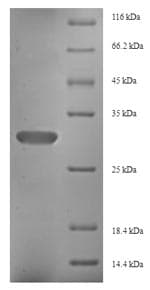 Human FGF13 Protein (Recombinant 6His, N-terminus)