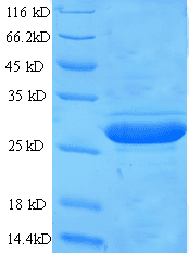 Mouse GPC4 / Glypican 4 Protein (Recombinant GST)