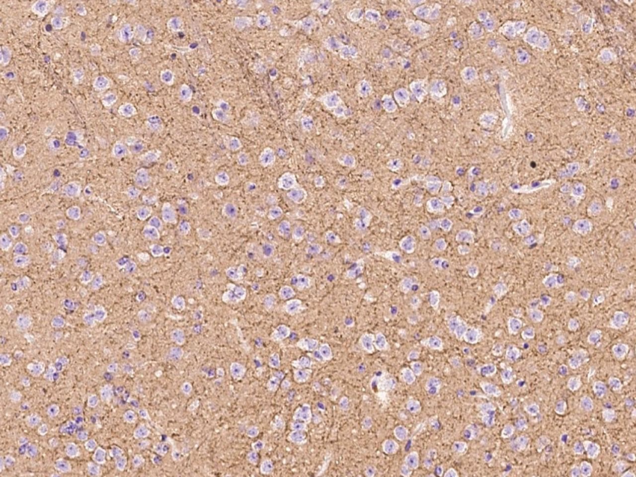 ATP1A3 Antibody