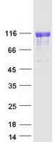 Human PIGR Protein (Recombinant Myc-DDK (Flag))
