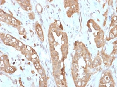 Recombinant Monoclonal Rabbit anti-Human VIL1 / Villin Antibody (clone VIL1/2310R, Azide-free,Carrier-free, aa179-311, IHC)