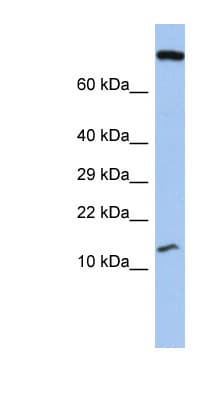 Polyclonal Rabbit anti-Human C5orf64 Antibody (aa71-120, WB)