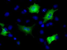 MCL1 / MCL 1 Antibody (clone OTI3A12)