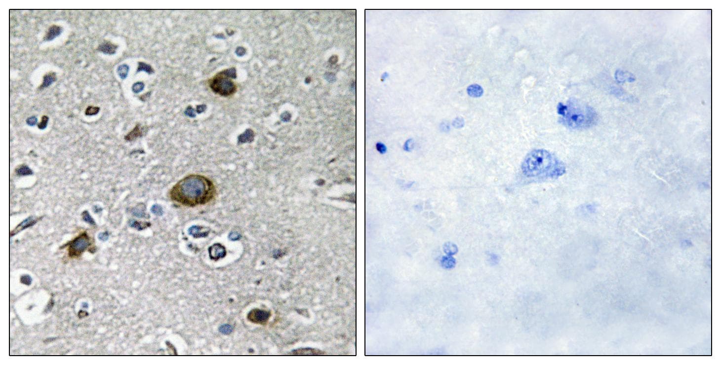 Polyclonal Rabbit anti-Human AKAP1 / AKAP Antibody (IHC, IF, WB)