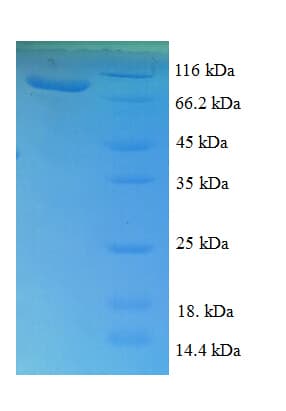 E. coli TKT / Transketolase Protein (Recombinant His-SUMO)