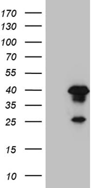 Monoclonal Mouse anti-Human AEBP2 Antibody (clone OTI10F3, Carrier-free, WB)