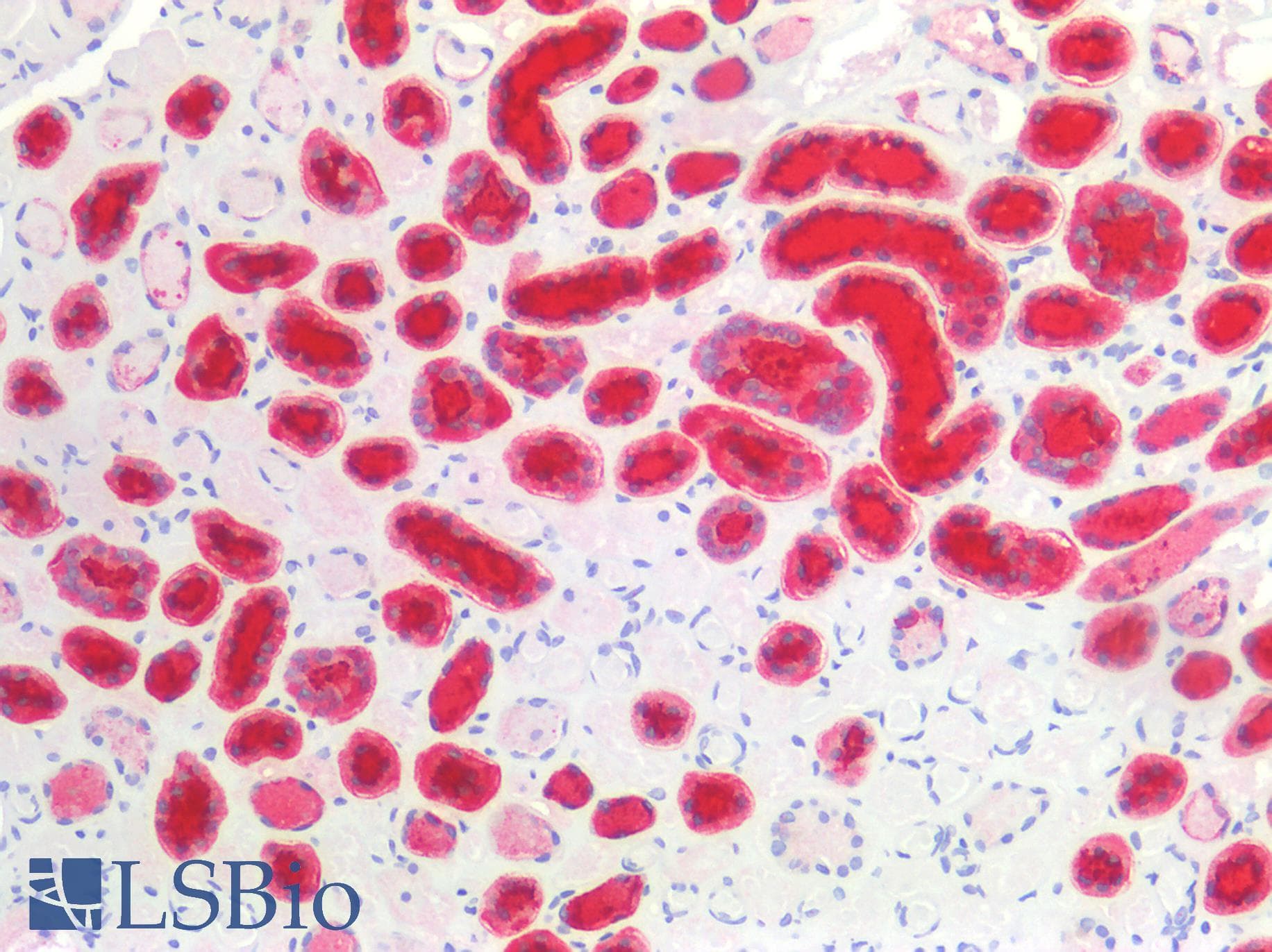IHC-plus™ EMA / MUC1 Antibody (clone E29)