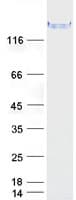 Human TRIP / LRRFIP1 Protein (Recombinant Myc-DDK (Flag))