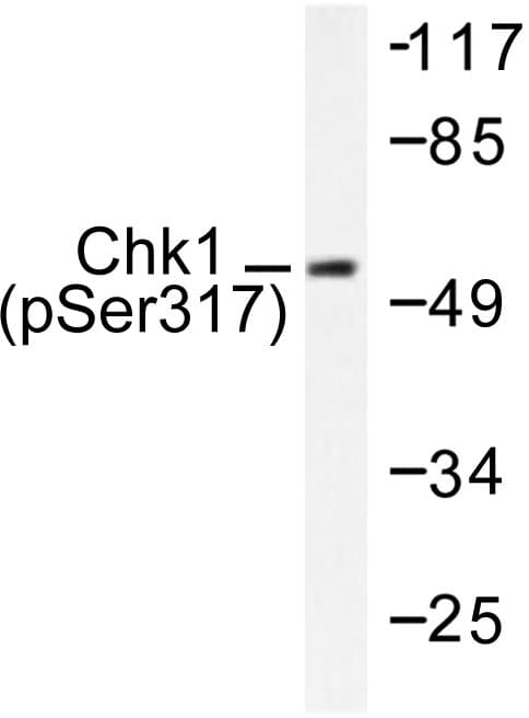 CHEK1 / CHK1 Antibody (phospho-Ser317)