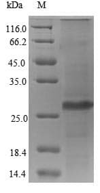 Human UL83 Protein (Recombinant 6His, N-terminus)