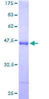Human UBCH10 / UBE2C Protein (Recombinant GST)
