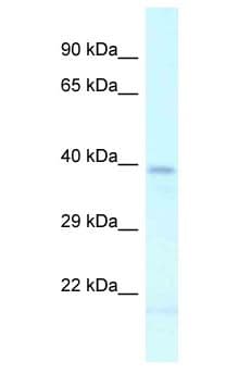 LHX2 Antibody (aa313-362)