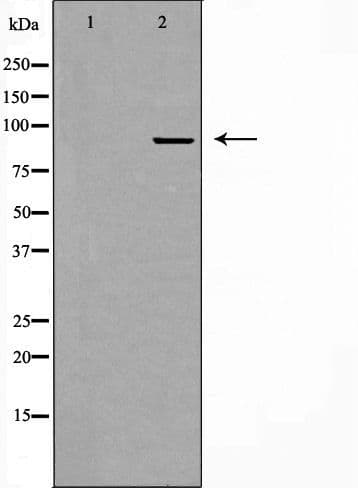 CHSY1 Antibody