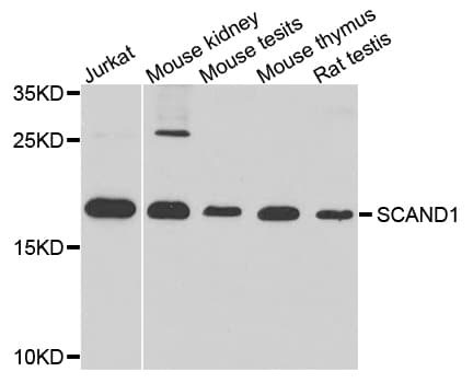 Polyclonal Rabbit anti-Human SCAND1 Antibody (WB)