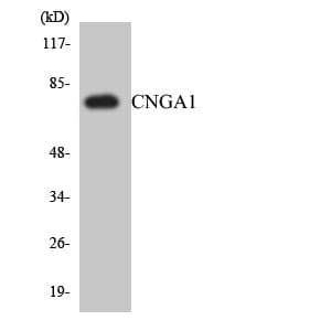 RP49 / CNG1 Antibody (aa384-433)