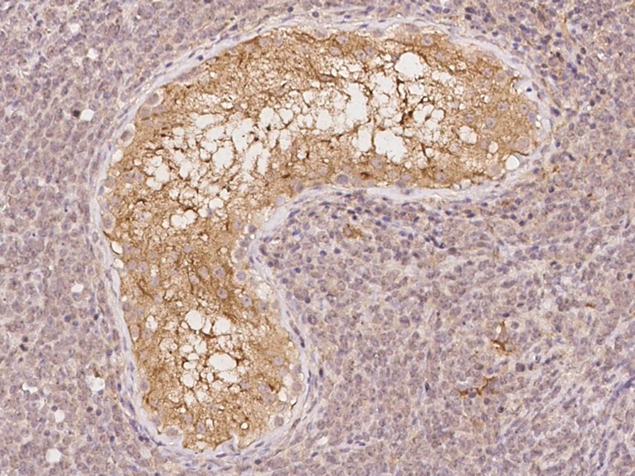Polyclonal Rabbit anti-Human EVPLL Antibody (IHC)