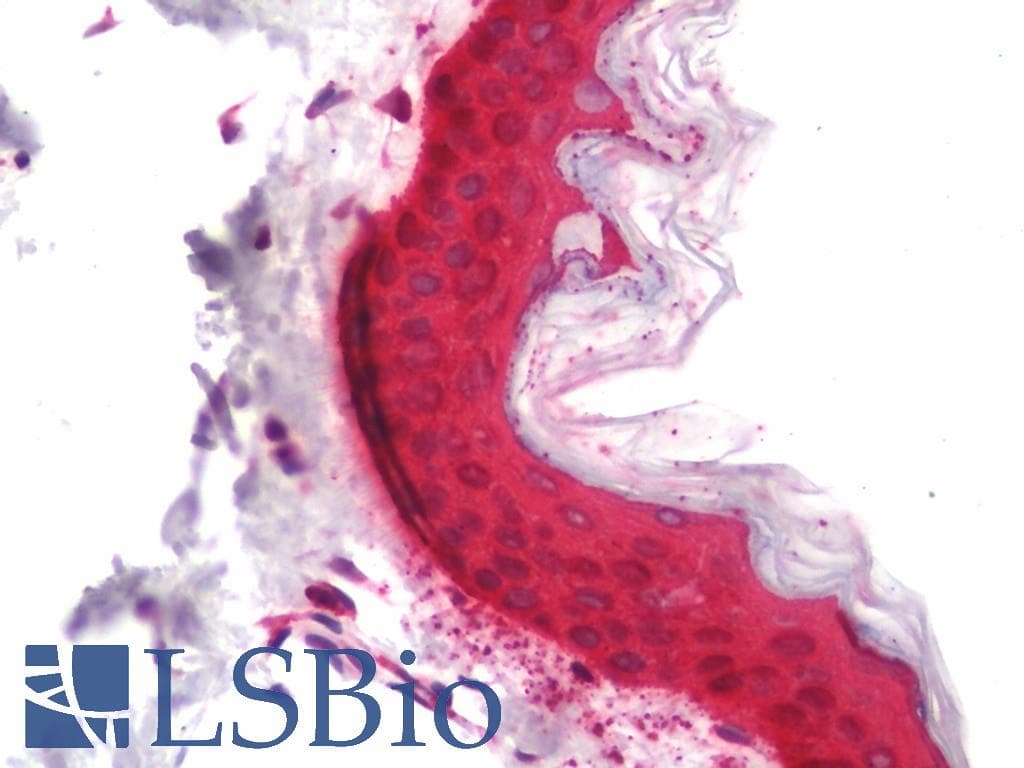 IHC-plus™ Polyclonal Rabbit anti-Human KRT5 / CK5 / Cytokeratin 5 Antibody (Synthetic peptide, corresponding to amino acids 550-600 of Human Cytokeratin 5., IHC, IF, WB)