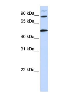 Polyclonal Rabbit anti-Human COG4 Antibody (aa684-733, WB)