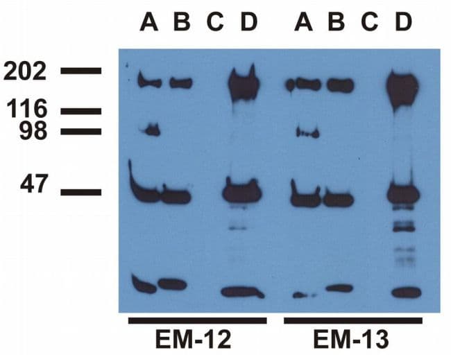 EGFR Antibody (Tyr992, clone EM-12)