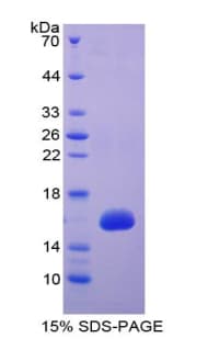 E. coli HTRA1 Protein (Recombinant His)