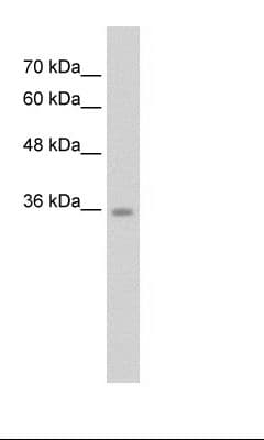 C6orf134 / ATAT1 Antibody (N-Terminus)