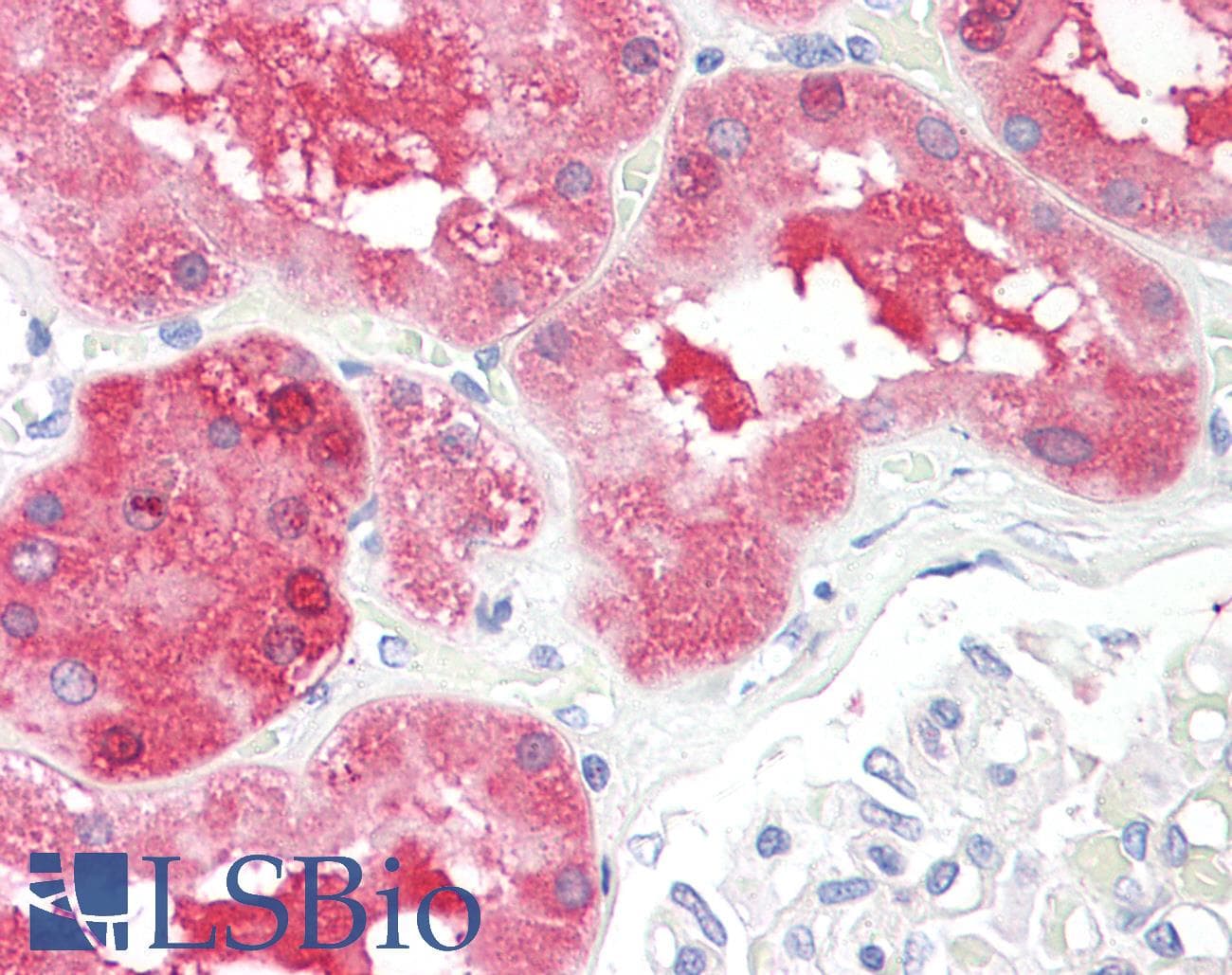 IHC-plus™ CBT1 / SDHD Antibody