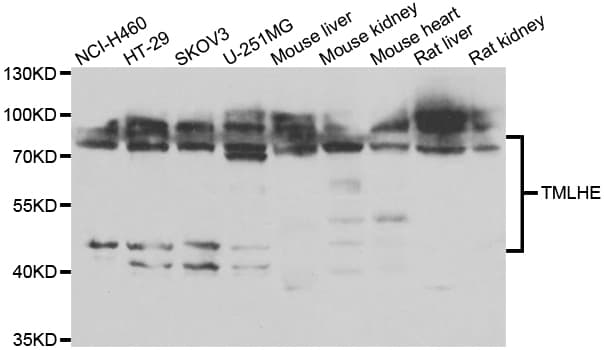 TMLHE / TMID Antibody