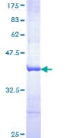 Human DLG4 / PSD95 Protein (Recombinant GST, N-terminus)