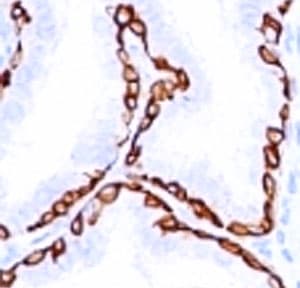KRT14 / CK14 / Cytokeratin 14 Antibody (C-Terminus, clone SPM263)