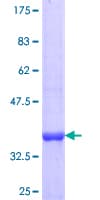 Human ANTXR1 / TEM8 Protein (Recombinant GST, N-terminus)