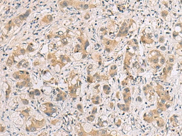RTP4 / IFRG28 Antibody