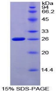 Mouse F8A1 / HAP40 Protein (Recombinant His-T7)