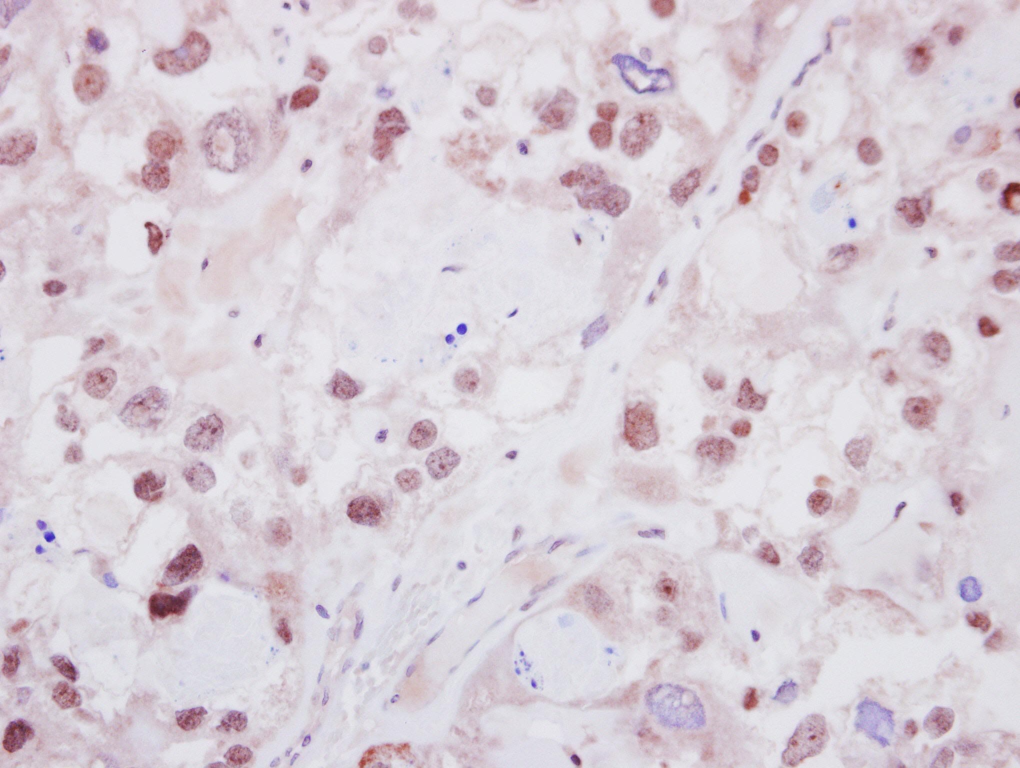 IKZF2 / HELIOS Antibody