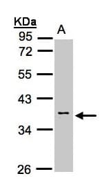 CASQ2 / Calsequestrin 2 Antibody (aa124-388)