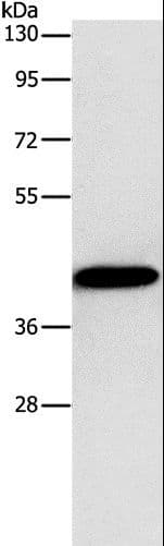 GJC1 / CX45 / Connexin 45 Antibody