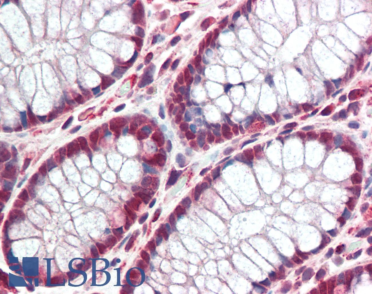 TP53BP2 / ASPP2 Antibody (aa133-182)